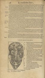 La septiesme figure du ventre inferieur - Les Oeuvres d'Ambroise Paré,...divisees en trente livres.  [...]