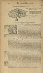 Troisiesme figure, demonstarnt le cerebellum & vermiformis - Les Oeuvres d'Ambroise Paré,...divisees [...]