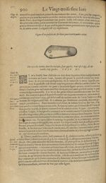 Figure d'un poulcier de fer blanc pour tenir le poulce esleué - Les Oeuvres d'Ambroise Paré,...divis [...]