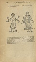 Figure d'un enfant masle ayant quatre bras & quatre iambes / Figure d'un homme au=yant une teste au  [...]