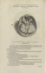 Decima tertia septimi libri figura [Crâne, cerveau retiré] - Andreae Vesalii,... de Humani corporis  [...]