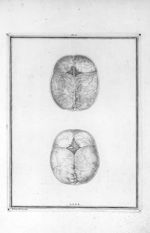 Vaisseaux du péricrâne et ceux de la dure-mere. Fig. 1. Surface extérieure et convexe du crâne recou [...]
