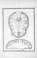 Coupe du cerveau, faite à la hauteur du corps calleux. Fig. 1. Espace médullaire (centre ovale latér [...]