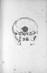 Pl. XL. Base du crâne d'un aliéné érotique avec un très-grand développement du cervelet - Anatomie e [...]