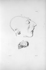 Pl. XIX. Fig. 1. Crâne d'un homme de vingt-cinq ans, complètement imbécile / Fig. 2. Conformation vi [...]