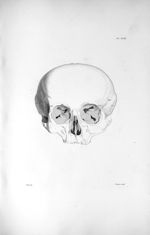Pl. XXVII. Crâne d'une femme publique, passionnée pour le vol, morte dans la prison de Grätz en Stir [...]