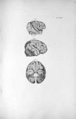 Pl. XXXIV. Fig. 1. Cerveau du singe (Rhésus-patas) / Fig. 2. Cerveau de l'orang-outang, vu de côté / [...]