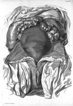 Tab. VII. [Position du l'utérus dans le ventre au septième ou huitième mois de grossesse] - Tabulae  [...]