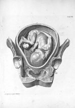 Tab. VIII. [Vue en coupe de l'utérus au septième ou huitième mois de grossesse] - Tabulae anatomicae [...]