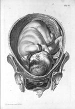 Tab. IX. [Vue en coupe de l'utérus au huitième ou neuvième mois de grossesse] - Tabulae anatomicae.  [...]