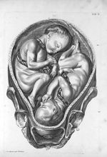 Tab. X. [Vue en coupe de l'utérus, à la fin d'une grossesse gémellaire] - Tabulae anatomicae. Accedi [...]