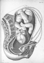 Tab. XII. [Utérus vue de côté, en fin de grossesse] - Tabulae anatomicae. Accedit earundem explicati [...]