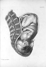 Tab. XIV. [Position du foetus, pendant l'accouchement] - Tabulae anatomicae. Accedit earundem explic [...]