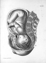 Tab. XX. [Position du foetus, vue du côté gauche, au moment de l'accouchement] - Tabulae anatomicae. [...]