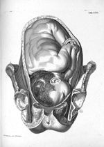 Tab. XXII. [Position du foetus au moment de l'accouchements] - Tabulae anatomicae. Accedit earundem  [...]