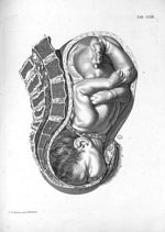 Tab. XXIII. [Position du foetus au moment de l'accouchement] - Tabulae anatomicae. Accedit earundem  [...]