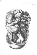 Tab. XXV. [Position du foetus au moment de l'accouchement] - Tabulae anatomicae. Accedit earundem ex [...]