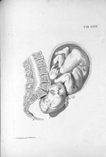 Tab. XXVII. [Position du foetus au moment de l'accouchement] - Tabulae anatomicae. Accedit earundem  [...]