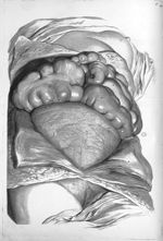 Mulieris ultra septem menses gravidae apertum abdomen  - Anatomia humani corporis, centum et quinque [...]