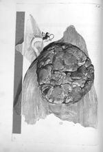 Placenta uterina - Anatomia humani corporis, centum et quinque tabulis, per artificiosiss. G. de Lai [...]
