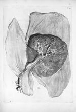 Placenta, membrana amnios, chorion et urinaria tunica - Anatomia humani corporis, centum et quinque  [...]