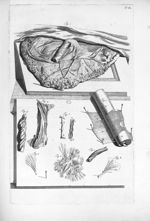Fig. 1. Uterina placenta / Fig. 2 et 6. Chorii portionem / Fig. 3. Arteria a vinculo ombilicali sepa [...]
