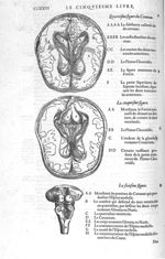 Cerveau - Les Oeuvres d'Ambroise Paré,... divisées en vingt huict livres avec les figures et portrai [...]