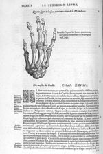 Face exterieure des os de la main droite - Les Oeuvres d'Ambroise Paré,... divisées en vingt huict l [...]