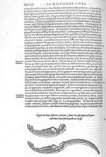 Deux bistories courbees - Les Oeuvres d'Ambroise Paré,... divisées en vingt huict livres avec les fi [...]