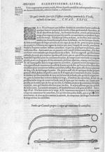 Sondes & cannules - Les Oeuvres d'Ambroise Paré,... divisées en vingt huict livres avec les figures  [...]