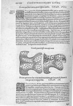 Corcelet pour dresser un corps tortu - Les Oeuvres d'Ambroise Paré,... divisées en vingt huict livre [...]