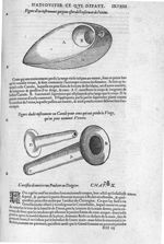 Reservoir de l'urine / Canule - Les Oeuvres d'Ambroise Paré,... divisées en vingt huict livres avec  [...]