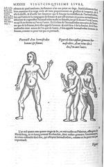 Hermafrodite homme & femme / Deux enfans gemeaux hermafrodites, estant ioints dos à dos - Les Oeuvre [...]