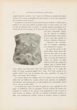 [Psoriasis] - Le musée de l'hôpital Saint-Louis : iconographie des maladies cutanées et syphilitique [...]