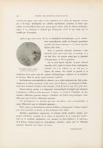 Trichophyton dans la squame - Le musée de l'hôpital Saint-Louis : iconographie des maladies cutanées [...]