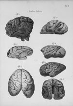 Grosses Gehirn - Schaedel, Hirn und Seele des Menschen und der Thiere