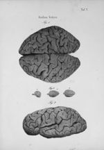 Grosses Gehirn - Schaedel, Hirn und Seele des Menschen und der Thiere