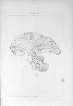 White fibres in the brain disposed in three series - A series of engravings intended to illustrate t [...]