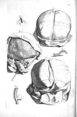Fig. 1, 2 et 4. The brain / Fig. 3 et 5. Longitudinal and lateral sinus / Fig. 6. Carotid artery - T [...]
