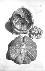 Fig. 1 et 2. The brain out of the skull / Fig. 3. The internal part of the basis of the skull - The  [...]