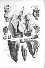 Fig. 1. Fore-parts of all the viscera within the cavity of the thorax / Fig. 2 et 3. Lobe of the lun [...]