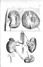 Fig. 1 à 4 et 6. The left kidney /  Fig. 5. The blood vessels and urinary tubes of the kidney / Fig. [...]