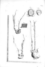 Fig. 1 à 3 et 5. The testes /  Fig. 4. The vessels of the testes - The anatomy of human bodies,... c [...]