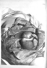 The abdomen of a woman open'd after seven months gone with child - The anatomy of human bodies,... c [...]