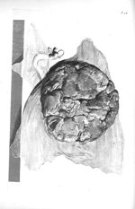 The external convext surface of the placenta uterina - The anatomy of human bodies,... containing ma [...]