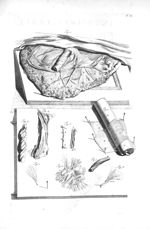 Fig. 1. The placenta uterina / Fig. 2 et 6. Part of the chorion / Fig. 3. Part of one of the umbilic [...]