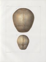 Planche 15 - Têtes - Ovale supérieur - Traité complet de l'anatomie de l'homme, par les Drs Bourgery [...]