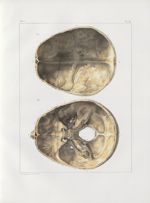 Planche 18 - Têtes - Surface intérieure du crâne. Adulte (grandeur naturelle) - Traité complet de l' [...]