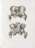 Planche 51 - Articulations pelviennes et coxo-fémorales - Traité complet de l'anatomie de l'homme, p [...]