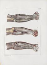 Planche 150 - Loges et cloisons aponévrotiques des muscles du bras et de l'avant-bras - Traité compl [...]